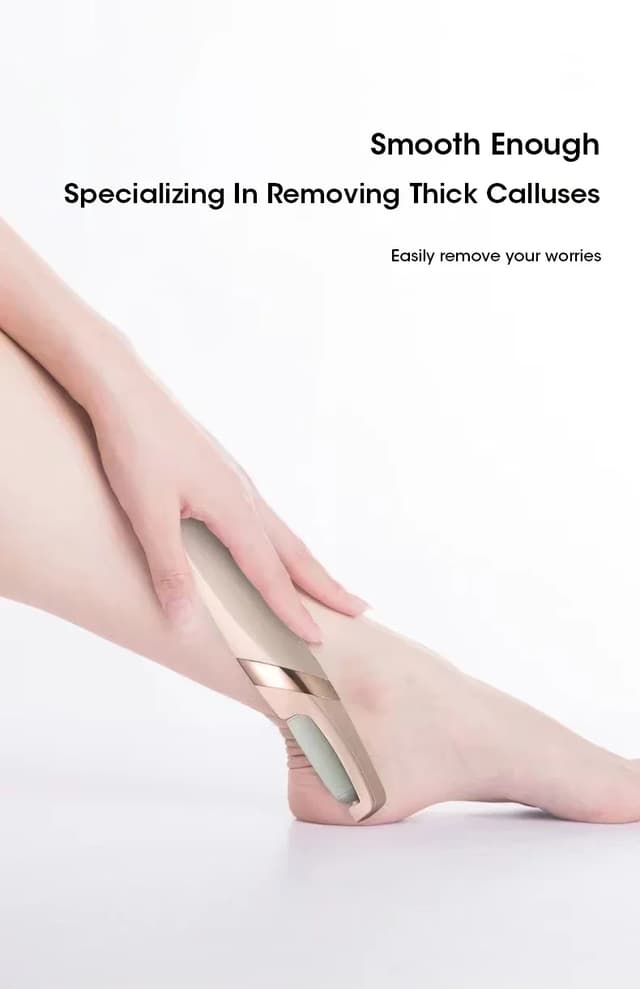 Rechargeable Electric Foot Callus Remover Pedicure Tool - USB Automatic Dead Skin Grinder with 2 Roller Heads for Smooth Feet showcase 5