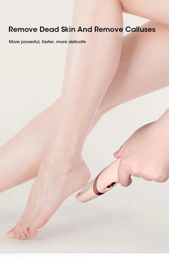 Rechargeable Electric Foot Callus Remover Pedicure Tool - USB Automatic Dead Skin Grinder with 2 Roller Heads for Smooth Feet showcase 3