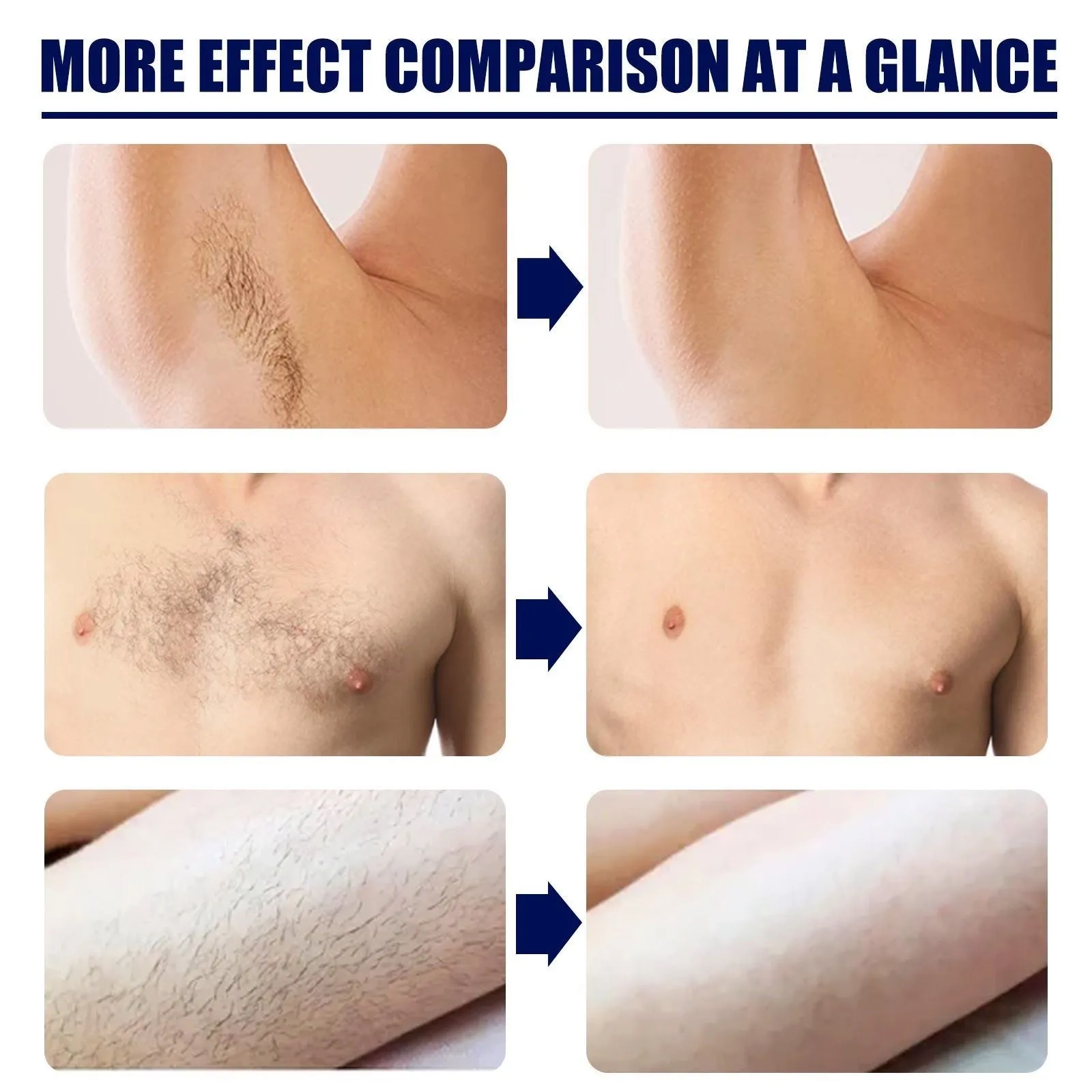 Men’s Hair Removal Cream – Gentle Body Hair Removal Cream for Chest, Underarms, Legs & Full Body, Smooth Skin thumbnail 2