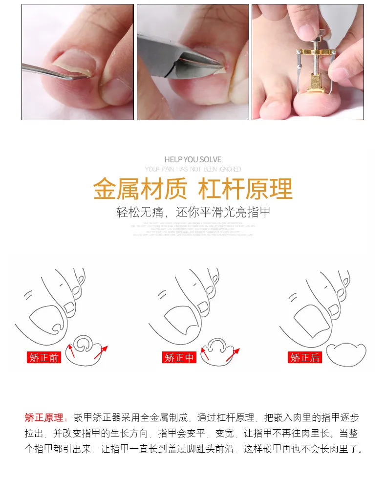 Professional Stainless Steel Nail Clipper Set for Ingrown Toenails - Precision Manicure Pedicure Tools for Thick Nails, Dead Skin Removal, and Nail Groove Care showcase 10
