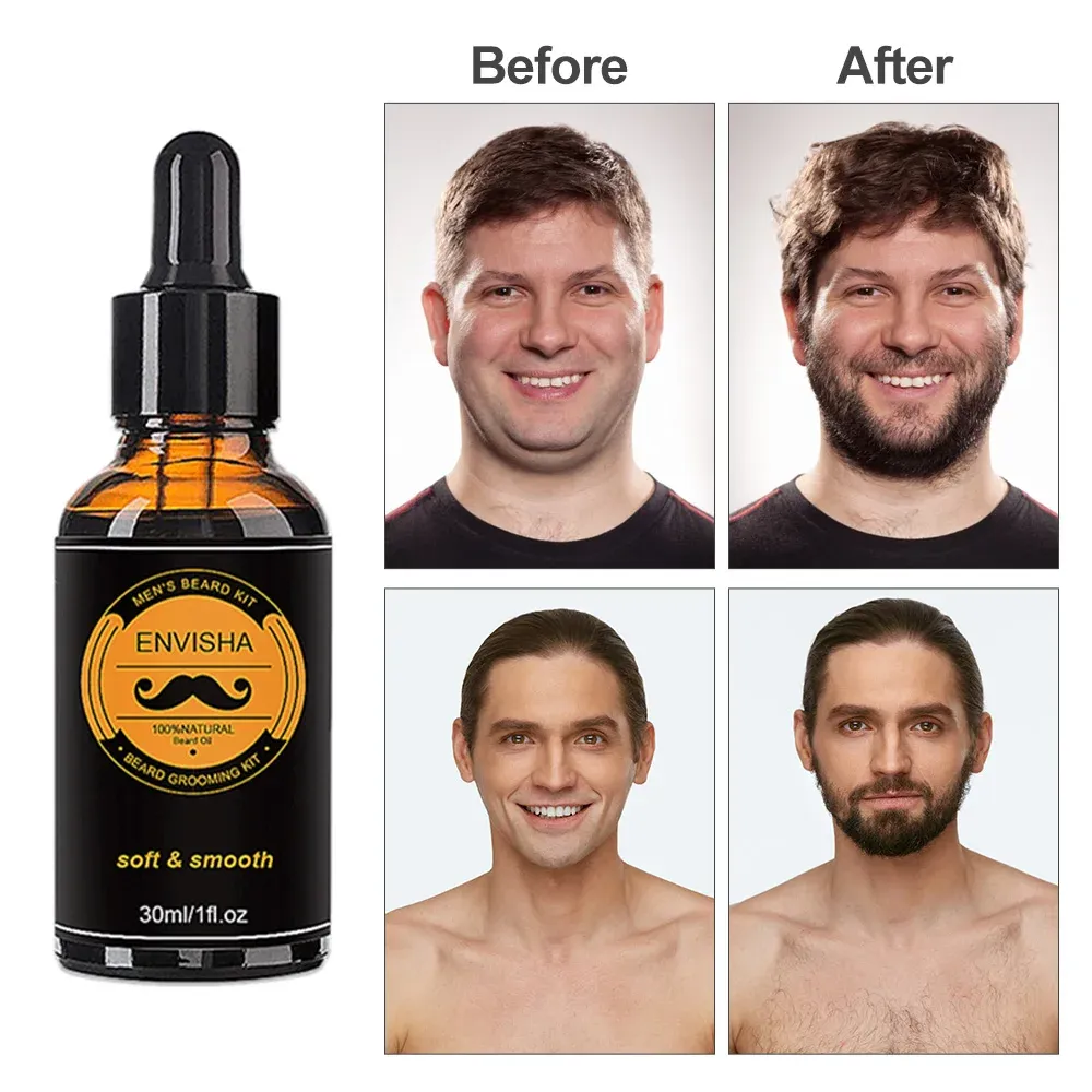 Complete Beard Growth Kit for Men: Natural Essential Oil, Moisturizing Balm, Growth Roller Comb, Styling Scissors, and Boar Bristle Brush for Full Beard Styling and Care showcase 13