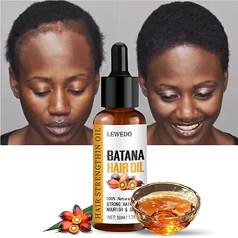 Lewedo Naturals Batana Oil for Fast Hair Growth - Pure Burahem Palm Oil for Men & Women, Nourishes Scalp, Reduces Split Ends, Promotes Healthy Shiny Hair, Anti Hair Loss Treatment