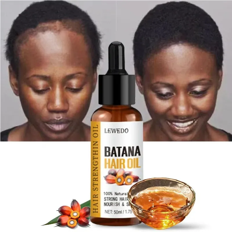 Lewedo Naturals Batana Oil for Fast Hair Growth - Pure Burahem Palm Oil for Men & Women, Nourishes Scalp, Repairs Damage, Reduces Split Ends, Promotes Healthy Shiny Hair thumbnail 1