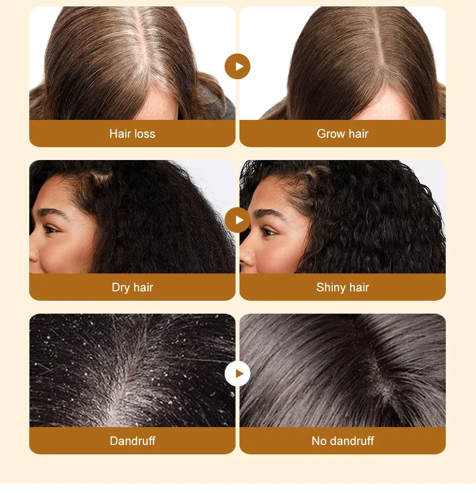 Lewedo Naturals Batana Oil for Fast Hair Growth - Pure Burahem Palm Oil for Men & Women, Nourishes Scalp, Repairs Damage, Reduces Split Ends, Promotes Healthy Shiny Hair showcase 10