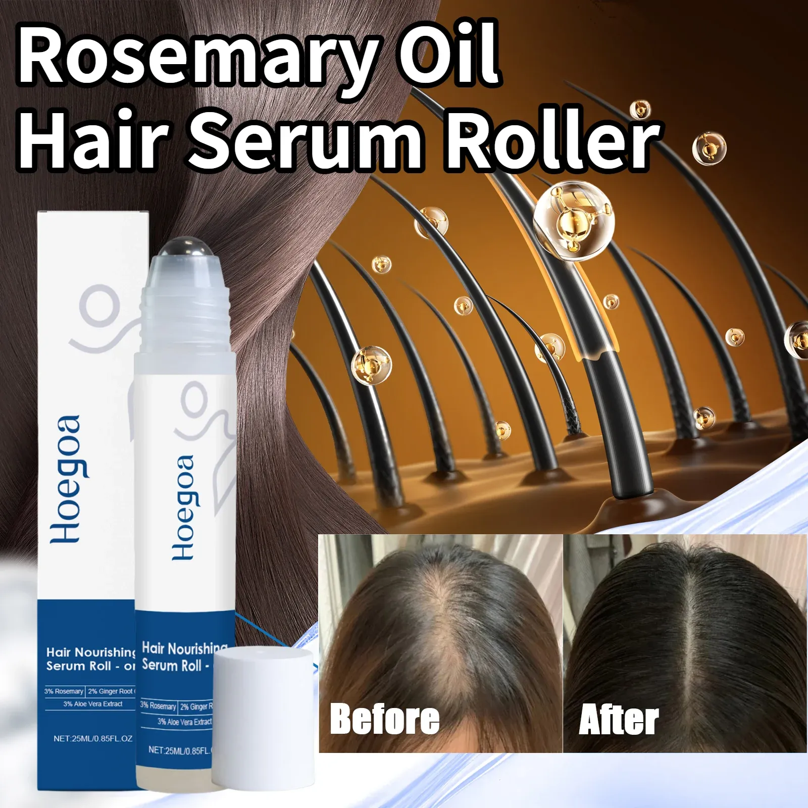 Ginger Hair Growth Oil Roller Serum for Stronger Roots & Scalp Treatment - Anti-Hair Loss Essence for Thicker, Shinier Hair - 25ml thumbnail 1
