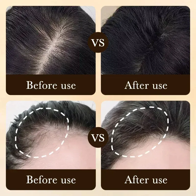 Biotin Hair Growth Oil for Men - Fast Scalp Treatment for Anti Hair Loss, Promotes Thicker, Stronger Hair Growth with Roller Massage Applicator - Image 2