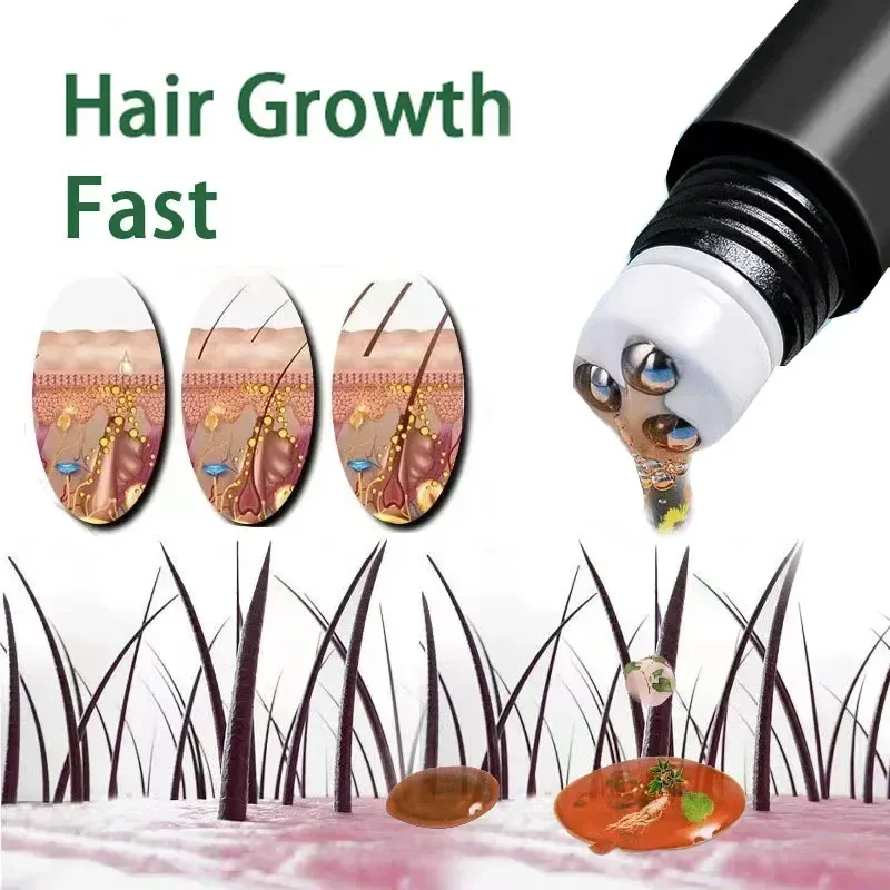 Biotin Hair Growth Oil for Men - Fast Scalp Treatment for Anti Hair Loss, Promotes Thicker, Stronger Hair Growth with Roller Massage Applicator - Image 1