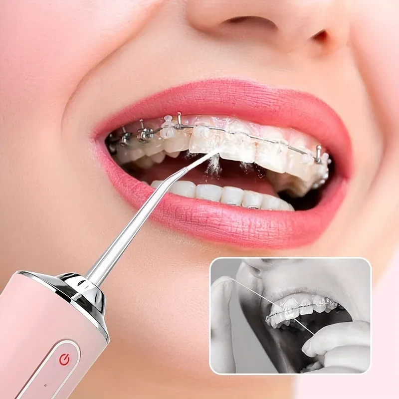 Portable Oral Irrigator Water Flosser for Teeth Cleaning - USB Rechargeable 220ml Tank, 3-Gear Settings for Interdental Care thumbnail 4