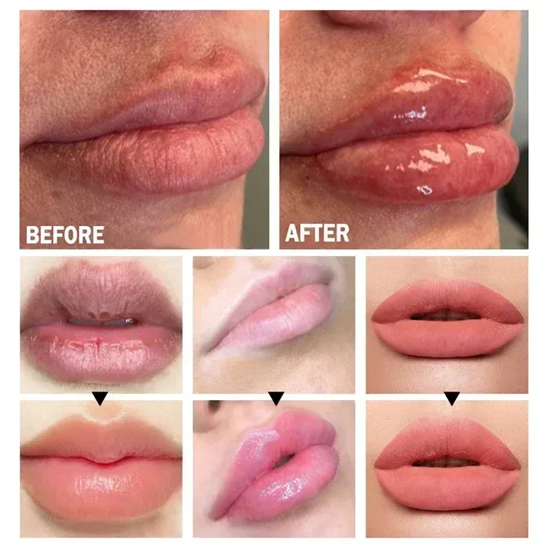 Instant Volumising Lip Plumper Oil Gloss Serum - Moisturizing Anti-Wrinkle & Dark Skin Remover for Fuller, Smoother Lips showcase 5