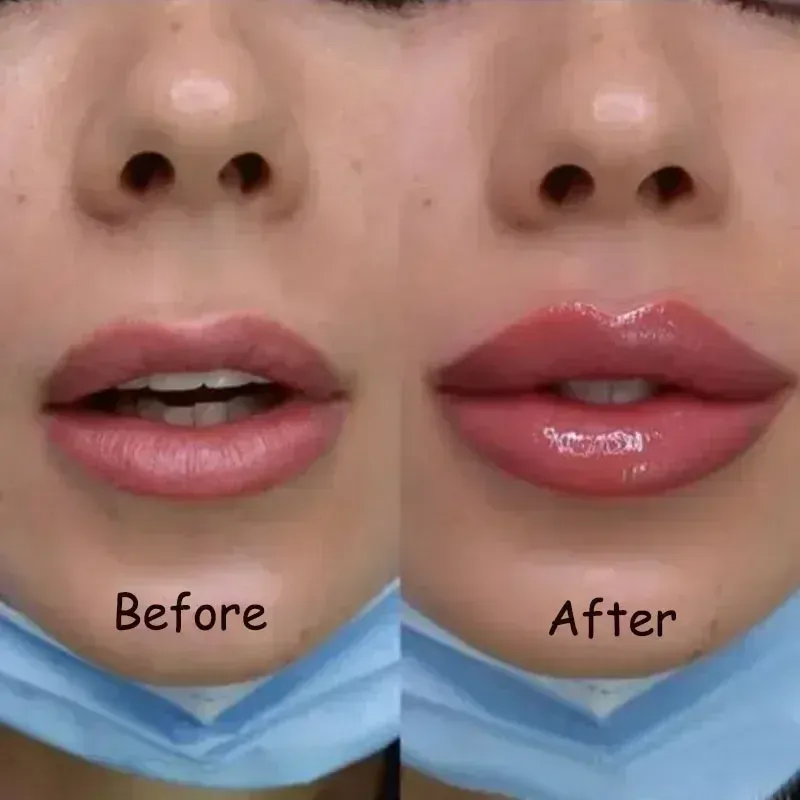 Instant Volumising Lip Plumper Oil Gloss Serum - Moisturizing Anti-Wrinkle & Dark Skin Remover for Fuller, Smoother Lips showcase 2