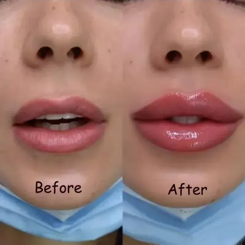 Instant Volumising Lip Plumper Oil Gloss Serum - Moisturizing Anti-Wrinkle & Dark Skin Remover for Fuller, Smoother Lips - Image 3